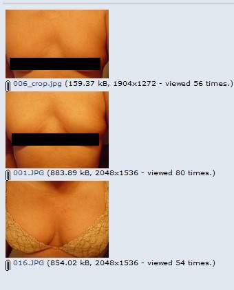 noogleberry-male-breast-enhancement-pump-for-crossdresser